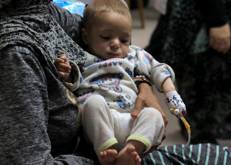 (240603) -- GAZA, June 3, 2024 (Xinhua) -- A Palestinian child suffering from malnutrition is seen at the Al-Aqsa Martyrs Hospital in central Gaza Strip city of Deir al-Balah, on June 2, 2024. (Photo by Rizek Abdeljawad/Xinhua)